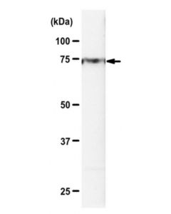 Millipore Anti-Hrd1 Antibody