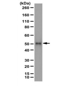 Millipore Anti-Sptlc1 Antibody