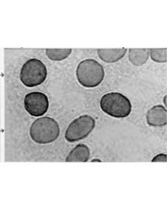 Millipore Anti-Hexokinase Type Iii Antibody, Clone C7c3