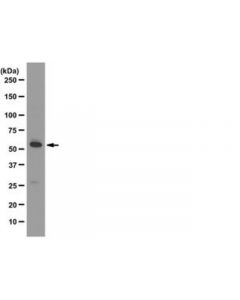 Millipore Anti-Atg5 Antibody, Clone 177.19