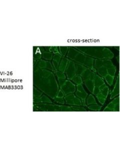Millipore Anti-Collagen Type Vi Antibody, Clone Vi-26