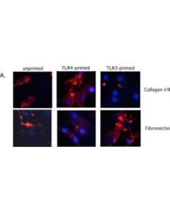 Millipore Anti-Collagen Type I Antibody, Clone 5d8-G9