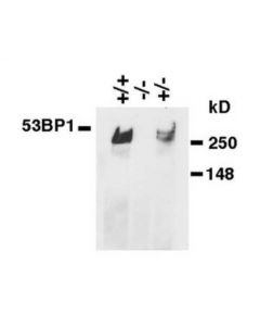 Millipore Anti-53bp1 Antibody, Clone Bp18