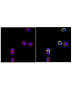 Millipore Anti-Neural Cell Adhesion Molecule L1 Antibody, Clone 324