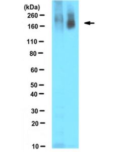 Millipore Anti-Poly Adp-Ribose Antibody, Clone 10h