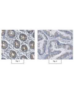 Millipore Anti-Tnfalpha Receptor Antibody, Clone 13f9.1