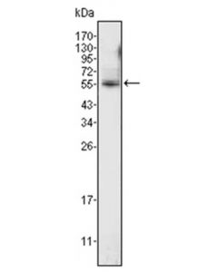Millipore Anti-Etv4 Antibody, Clone 1a2g3