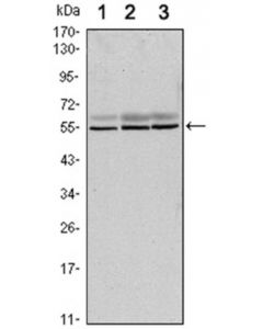 Millipore Anti-Smad6 Antibody, Clone 5h3