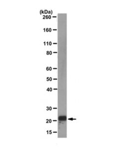 Millipore Anti-P21waf1 Antibody, Clone Ea10