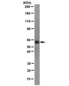Millipore Anti-N-Myc Antibody, Clone Ncm Ii 100