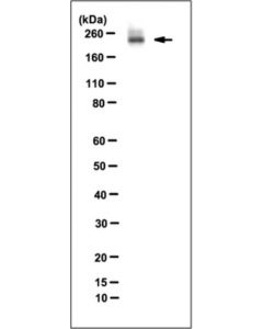 Millipore Anti-Mi-2beta Antibody, Clone 2g8