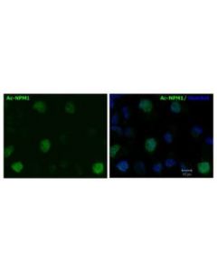 Millipore Anti-Acetylated Nucleophosmin Antibody, Clone 31m1