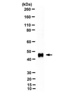 Millipore Anti-Mcpyv Large T-Antigen Antibody, Clone Cm2b4