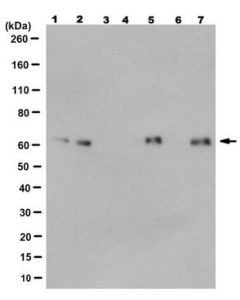 Millipore Anti-Beta-Dystrobrevin Antibody, Clone 6b5.1