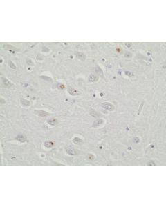 Millipore Anti-C9orf72/C9rant (Poly-Gr) Antibody, Clone 5a2