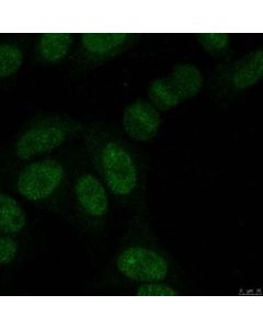 Millipore Anti-Sumo-2/3 Antibody, Clone 8a2