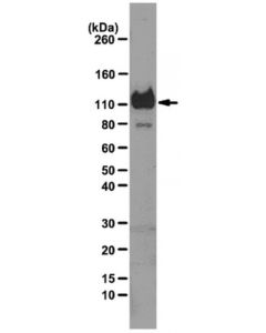 Millipore Anti-Libs2 Epitope (Integrin Beta3 Subunit) Antibody, Clone