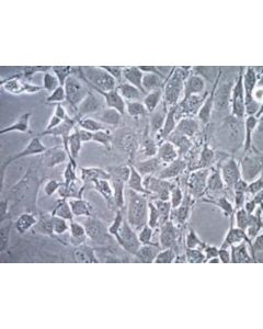 Millipore Embryomax(R) Jk1 Murine Testicular Stromal Feeder Cell ; MILL-SCC169