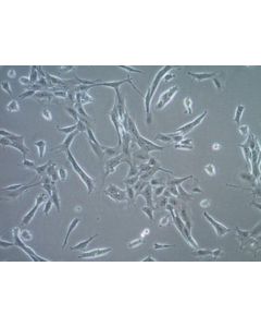 Millipore Ts/A Mouse Mammary Adenocarcinoma Cell Line