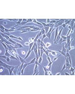 Millipore Ct-2a Mouse Glioma Cell Line; MILL-SCC194
