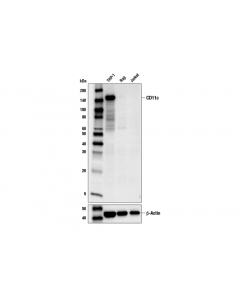 Cell Signaling Human Reactive M1 Vs M2 Macrophage Ihc Antibody Sa; CSIG-84223T