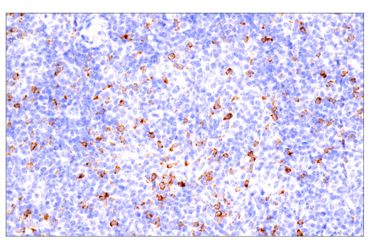 Explore CTLA-4 antibodies from CST including a new, reliable CTLA-4 Antibody for IHC.
